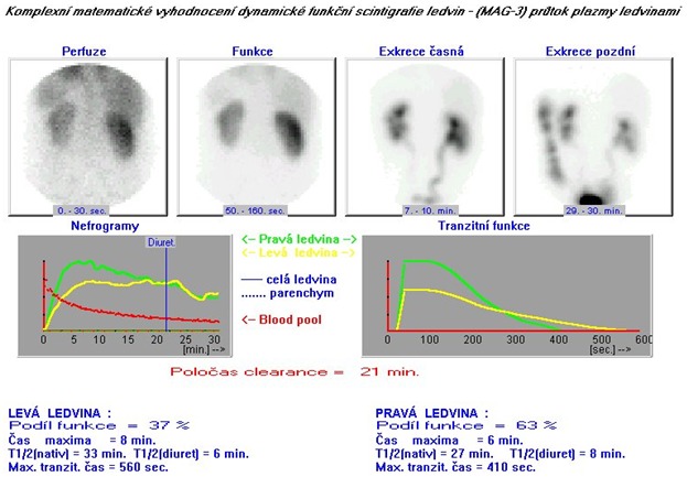 Obr. . 1: Dynamick scintigrafie ledvin v poloze vlee v zadn projekci