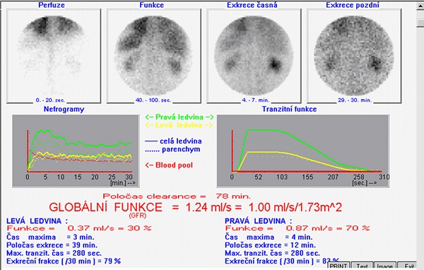 Obr. 3: Zvren protokol dynamick scintigrafie ledvin s DTPA