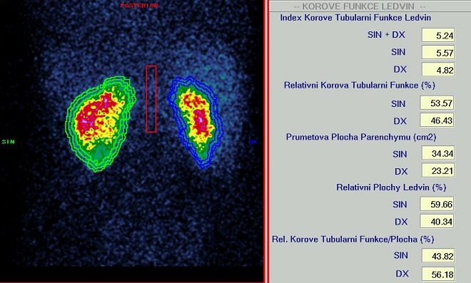 Obr. 1. Indexy korov tubulrn funkce a relativn korov tubulrn funkce