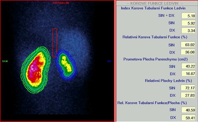 Obr. 1. Indexy korov tubulrn funkce a relativn korov tubulrn funkce