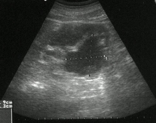 Obr. č. 2: Ultrasonografické vyšetření břicha