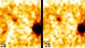 Obr. 7. SPECT dutiny bin, transversln ez.