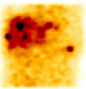 Obr. 10. SPECT dutiny bin, koronrn ez