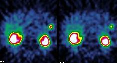 Obr. 25. SPECT dutiny bin,