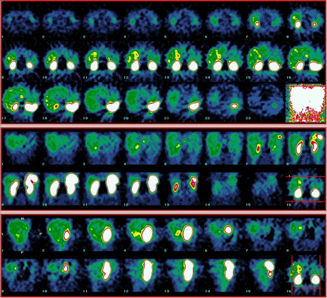 Obr. 3.: SPECT bicha