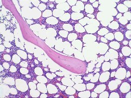 Obrázek č. 5: Histologie ze „zdravé“ lopaty kosti kyčelní