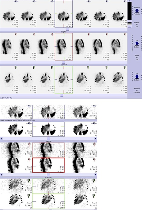 Obr. . 9a, b: Tomografick scintigrafie (SPECT) bicha