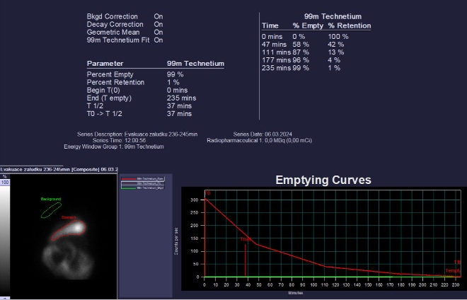 Obr.�.2: Scintigrafie evakuace �aludku.