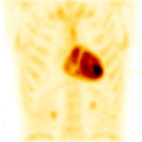 Obr. 3: SPECT, transverz�ln� �ez.