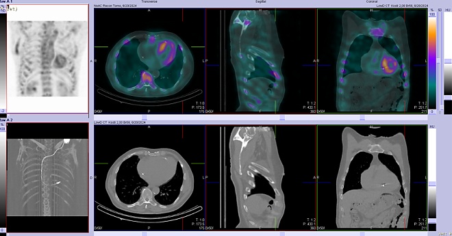 Obr. č. 3: SPECT/CT.