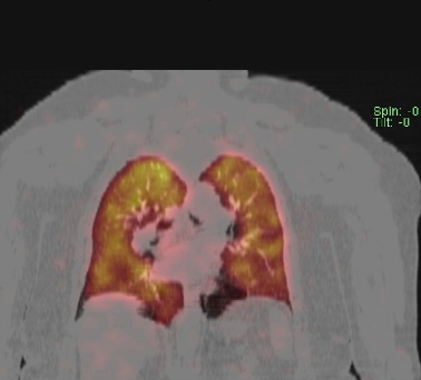 Obr. . 3 - 10: SPECT/CT plic.