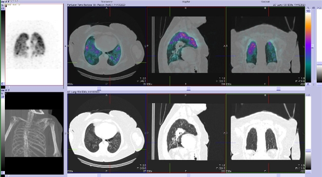 Obr. . 3 - 10: SPECT/CT plic.