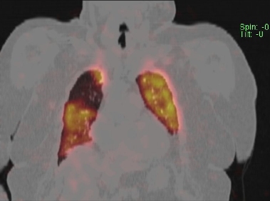 Obr. . 3 - 10: SPECT/CT plic.