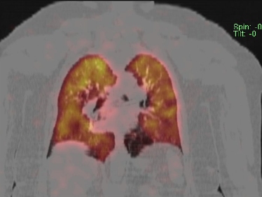 Obr. . 3 - 10: SPECT/CT plic.
